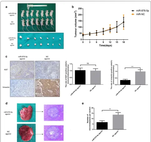 Fig. 6 MiR-876-5p inhibits vimentin expression and suppresses hepatic metastasis of HNSCC cells in vivo