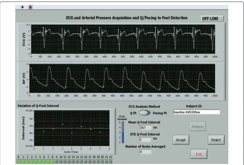 Table 2 Effect of Tailored Echo Guided Biventricular Pacemaker Optimization