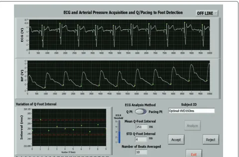 Figure 2 A Case Example showing Radial Artery PEP Measurement After Echo-Guided Pacemaker Optimization