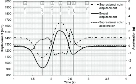 Figure 1: Breast and suprasternal notch vertical displacement (left axis) and suprasternal notch vertical acceleration (right axis) during a typical counter-movement jump