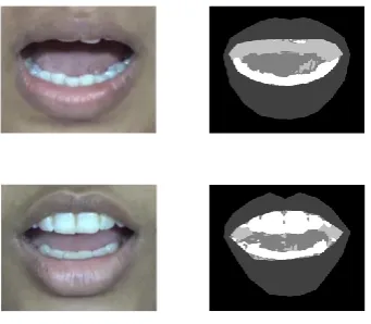 Fig. 2. Sample images and mask after pre-processing  