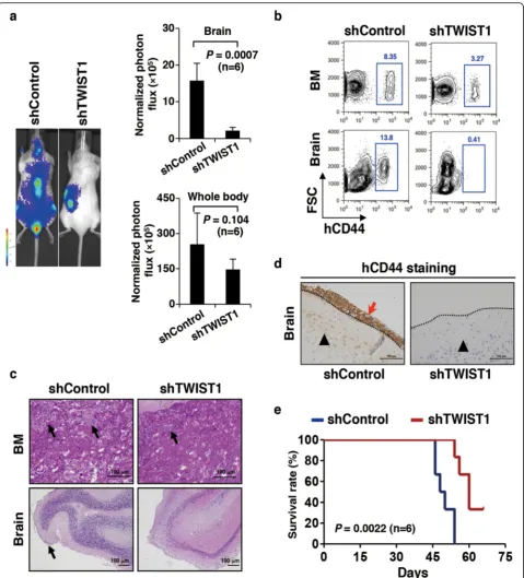 Fig. 6 TWIST1 mediates enhanced cell migration ability in vivobrain meninges.. a Representative bioluminescent imaging of mice transplanted with OCI-AML3 cellscarrying luciferases and stably expressing scramble shRNA (shControl) or shRNA targeting TWIST1 (