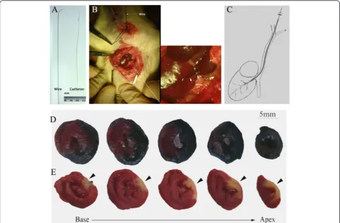 Figure 5 Transjugular cardiac vein retroinfusion and its perfusion area in LAD-ligated hearts