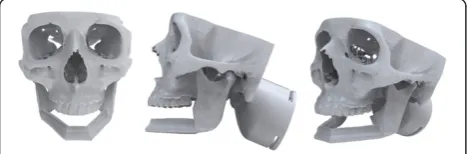 Figure 2 On-screen digital plan. Representation of the on-screen digital plan of the mandible reconstruction reviewed with the participants atthe beginning of Session B.