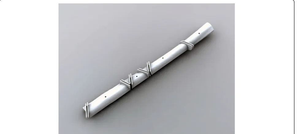 Figure 6 External fixator. Representation of the patient specific external fixator screwed onto the rami.