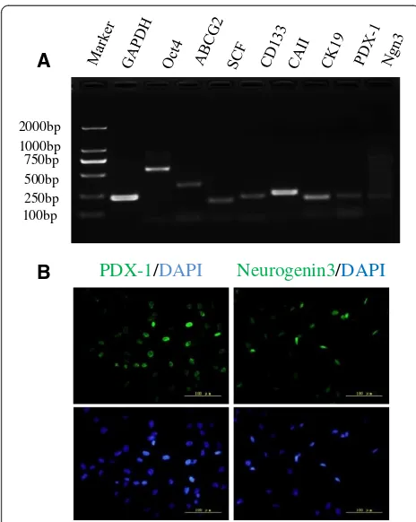 Figure 2 Identification of human pancreatic progenitor cells.staining for endocrine progenitor cell markers, PDX-1 and Ngn3, in(A) RT-PCR result for stem cell markers expressed on human fetalpancreatic progenitor cells