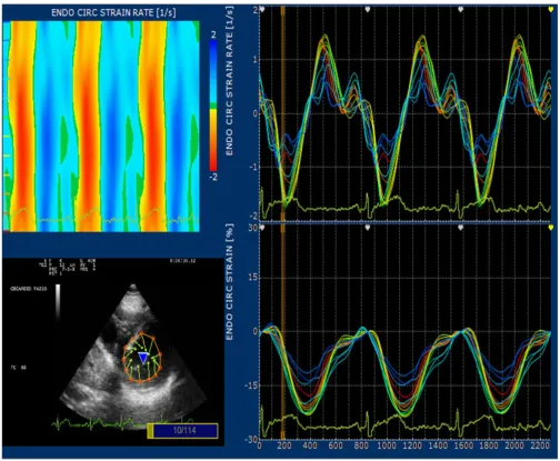 Figure 3Graph with parts of the processing result of a short axis view at mitral levelGraph with parts of the processing result of a short axis view at mitral level