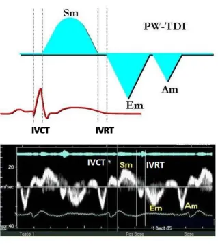 Figure 2phases of the cardiac cycleExample of a normal PW-TDI spectral curve: note the immediate representation of the mechanical events in the various Example of a normal PW-TDI spectral curve: note the immediate representation of the mechanical events in