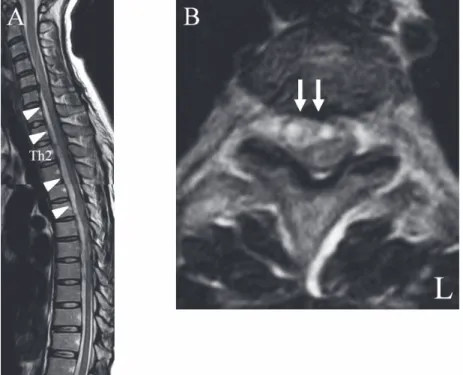 Fig. 3.  Preoperative computed tomographic image of the  brain.