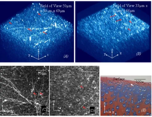 Figure 1. A 3D image of normal cartilage (ICRS grade 0, shown in Fig. 1(lagen fibres in the superficial zone appear to align predominantly in a direction parallel to the AC surface in 2D images