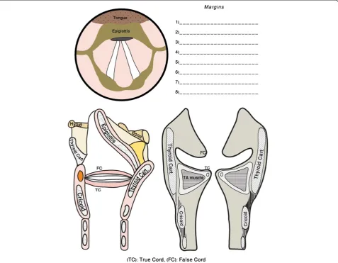 Figure 1 Laryngeal cancer template.
