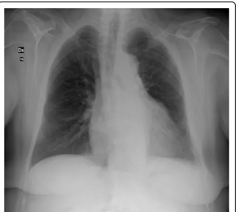 Figure 1 Chest antero-posterior X-ray.