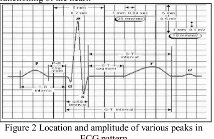 Figure 1 Typical ECG signal and its various Peaks. 