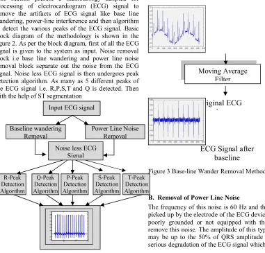 figure 2. As per the block diagram, first of all the ECG 