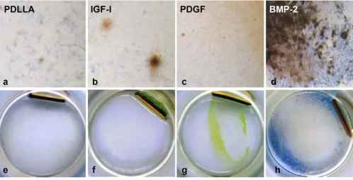 Figure 2a-d) hOB 15 days after culturing with different growth factors stained with a combination of AP (blue) and v