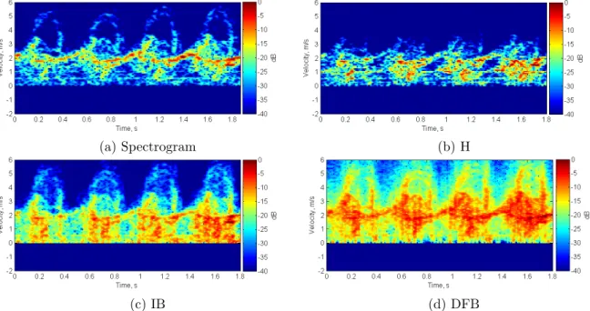 Figure 5.11: Bispectrum-based TFDs computed for real radar data of human walking.