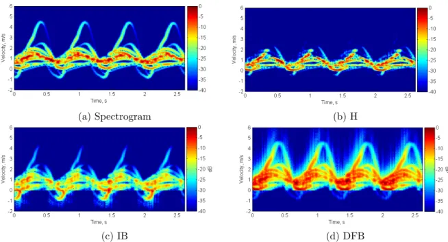 Figure 5.10: Bispectrum-based TFD computed simulated radar signal of human walking: (b) H, (c) IB, (d) DFB; compared to spectrogram (a).