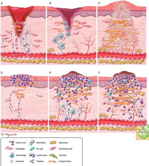Figure 1. Comparative models of wound healing and tumor stroma. (A) The first phase of wound healing involves hemostasis; platelets form clot at the injury site, which transforms to fibrin