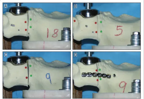 Figure 3 Representative photos of displacement at the fracture site with all four fixation schemes at 2000 N of loading are shown