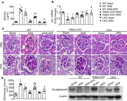 Figure 2. Deficiency of lipocalin-2 protects mice from ANS-induced glomerular injuries in the kidney