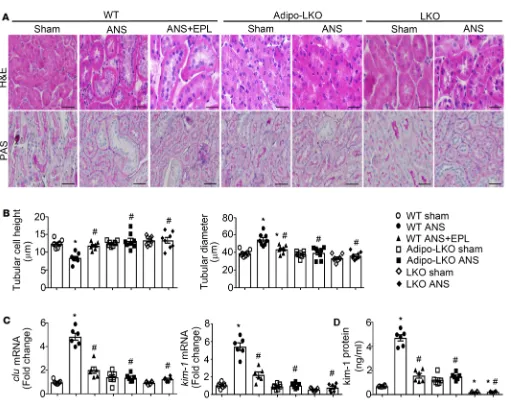 Figure 3. Deficiency of lipocalin-2 protects mice from ANS-induced tubular injuries in the kidney
