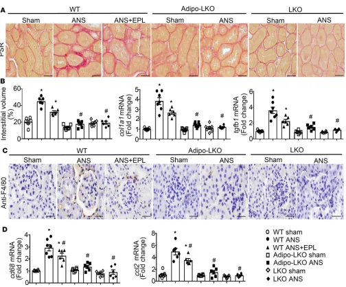 Figure 4. Deficiency of lipocalin-2 protects mice from ANS-induced interstitial fibrosis and macrophage infiltration in the kidney