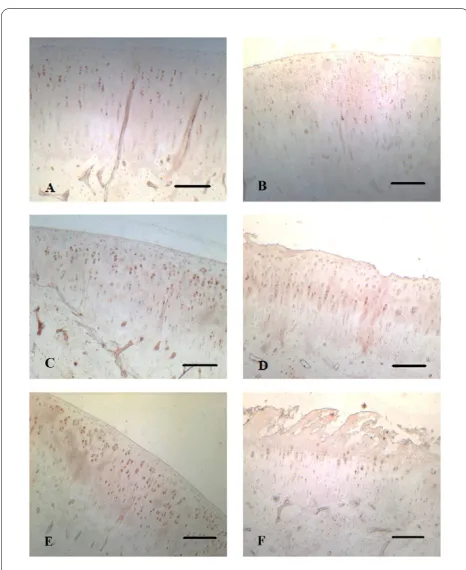 Figure 3 Correlation between the histologic grade of osteoarthri-tis (OA) according to the Mankin scale and expression of PTH1R