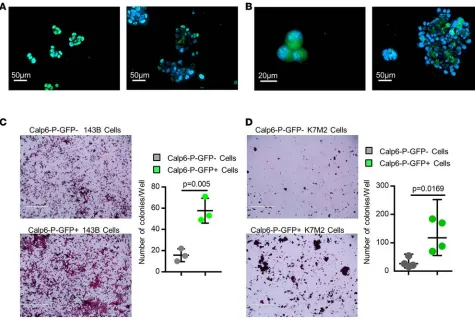 Figure 3. Calpain-6 expression is associated with stem cell features. (A and B) Fluorescence microscopy of GFP in little spheres (left panel) and large spheres (right panel) of 143B cells (A) and K7M2 cells (B)