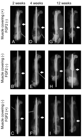 Figure 1are shownRepresentative plain radiographs of pasteurized bone grafts at 2 weeks (A-C), 4 weeks (D-F) and 12 weeks (G-I) after grafting Representative plain radiographs of pasteurized bone grafts at 2 weeks (A-C), 4 weeks (D-F) and 12 weeks (G-I) af