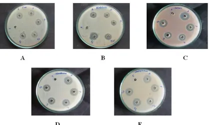 Fig. 8. Antifungal activity of leaf extract of Pedalium murex against (A). Aspergillus niger, (B)