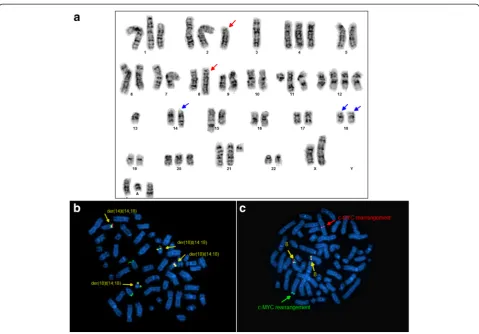 Table 2 Clonal cytogenetic abnormalities in lymphoma cells from primary bone marrow sample and from RC cell line