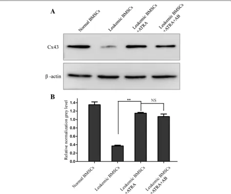Fig. 2 Effects of ATRA and amphotericin-B pretreatment on Cx43 protein level in leukemic BMSCs.was 1.35 ± 0.17 in healthy controls ( a Cx43 protein (normalized against β-actin)N = 10), 0.37 ± 0.02 in leukemic BMSCs (N = 25) treated with DMSO, 1.15 ± 0.03 i