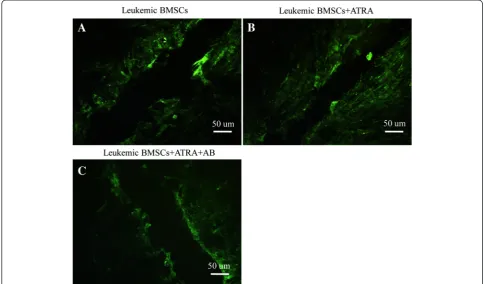 Fig. 3 Effects of dye transfer between BMSCs by using laser confocal microscopy. a Leukemic BMSCs not exposed to ATRA; b leukemic BMSCsexposed to ATRA (10 M); c leukemic BMSCs treated with both ATRA and amphotericin-B