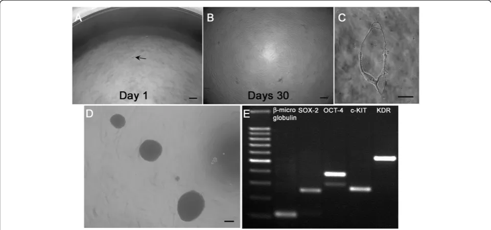 Figure 3 Human cadaver mesenchymal stromal/stem cell stemness property.cadaver mesenchymal stromal/stem cell (hC-MSC) (arrow) thatNonclonogenic single cell with a ring-shaped morphology (scale bar = 10are generated (scale bar = 50SOX2, OCT-4, c-KIT and KDR