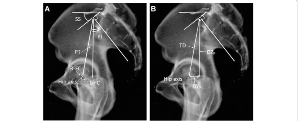 Fig. 1 Definition of the center of the sacral end plate of S1. The center of the sacral end plate of S1 (c) is defined as the point that divided theright and left halves in the coronal plane (a) and divided the front and rear halves in the sagittal plane (b)