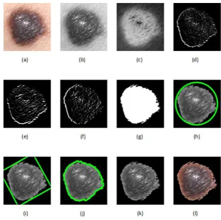 Fig. 2.  Accuracy of correctly and incorrectly   