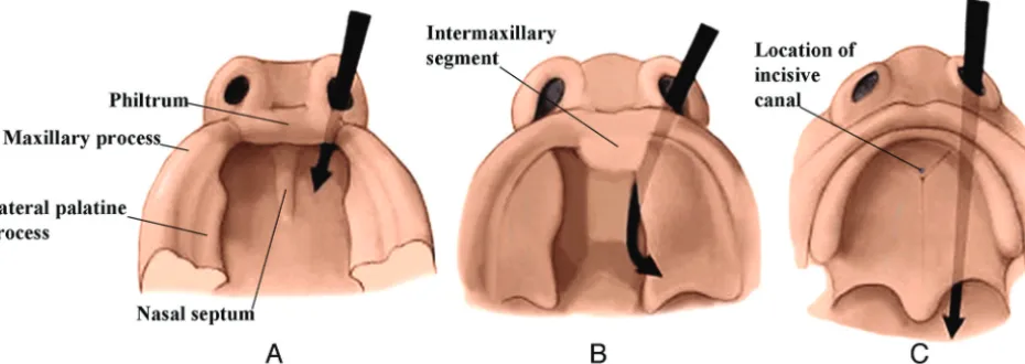 FIG 2. Serial frontal diagrams (A–D) from approximately 6–10 fetal weeks shown just posterior to the intermaxillary segment illustrate theprogressive development of the secondary palate and its fusion with the nasal septum.