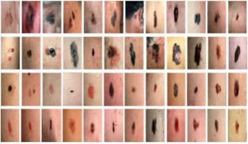 Fig. 9.  Samples of DermIS dataset 