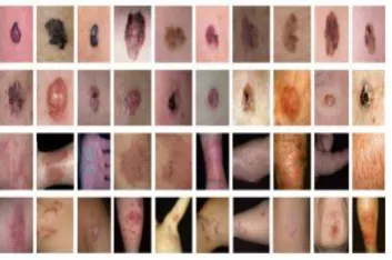 Fig. 11.  Samples of DermNet dataset                   