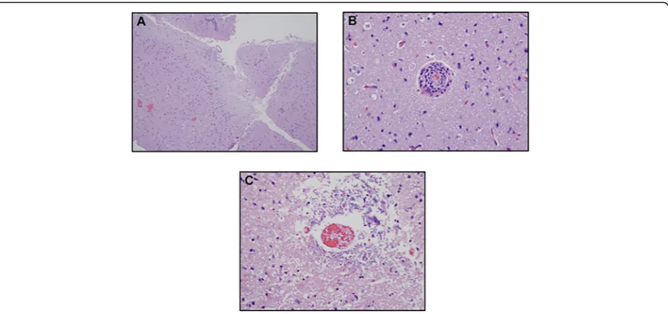 Fig. 4 Neuropathological Immunohistochemical Staining on Paraffin Embedded Formalin Fixed Tissue: a A MXA preparation highlightsendothelium (× 100)