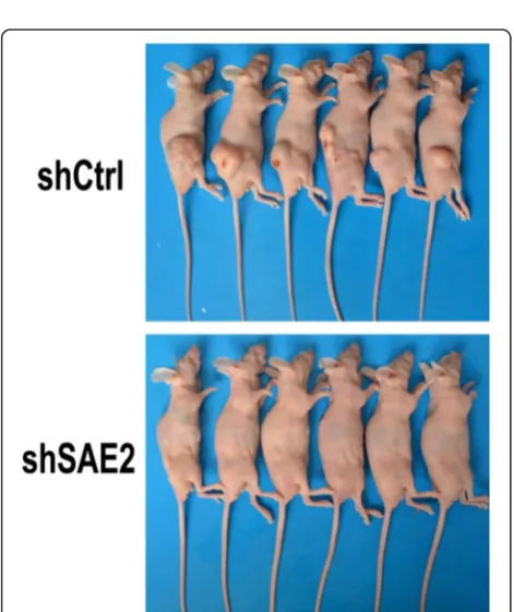Table 1 Effects of down-regulation SAE2 expression onsubcutaneous tumor-forming rate in nude mice
