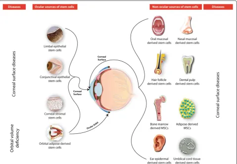 Figure 2 Status of ocular and non-ocular stem cell transplantation for anterior surface disorders of the eye