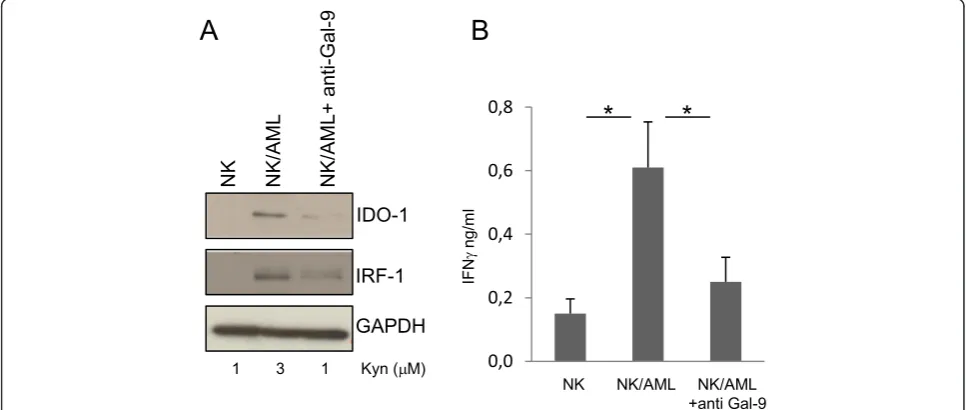 Figure 1 NK/AML co-culture induces TIM-3/Gal-9-dependent IDO-1 activation. BM samples from children with AML at diagnosis were processed byFicoll-Paque Plus to obtain BM mononuclear cells