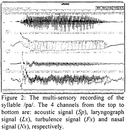 Figure 3: Multi-sensory recording of the syllable /ma/. Note that nasal resonance occur at the 