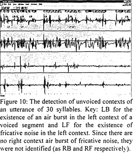 Figure 9: Detection of voiced segments using the signal. The segments found are indicated by a 