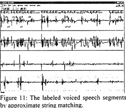 Figure 11: The labeled voiced speech segments by approximate string matching. 
