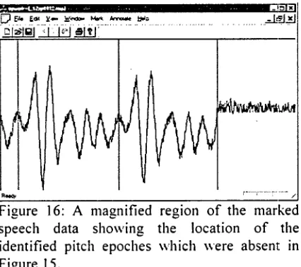 Figure 15: Visualization of the marked speech data. The dark ribbon shows the non-silence 