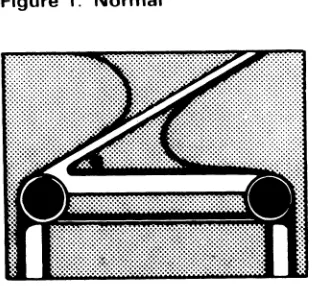 Figure 1 indicates normal columns Variations and tape position in the stubby while tape is moving forward or backward