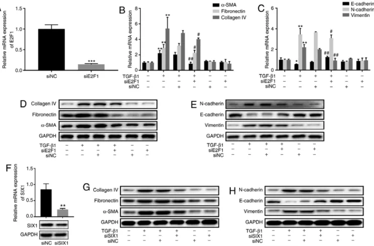 Figure 6. Effect of E2F1 and SIX1 on TGF‑ β 1‑induced fibrosis and EMT in BEAS‑2B cells
