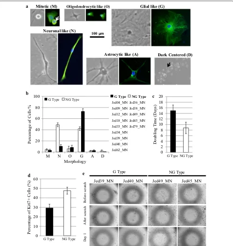 Fig. 2 Biological characteristics of meningioma primary cell lines. a Observed morphological characteristics showing cells displaying different phase and Vimentin stained structures